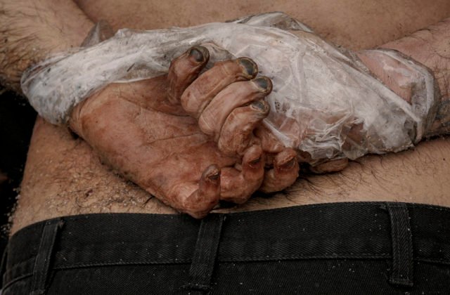 Ruky mali zviazané za chrtom a prestrelené kolená. Polícia už vyšetruje úmrtia viac ako 12-tisíc Ukrajincov