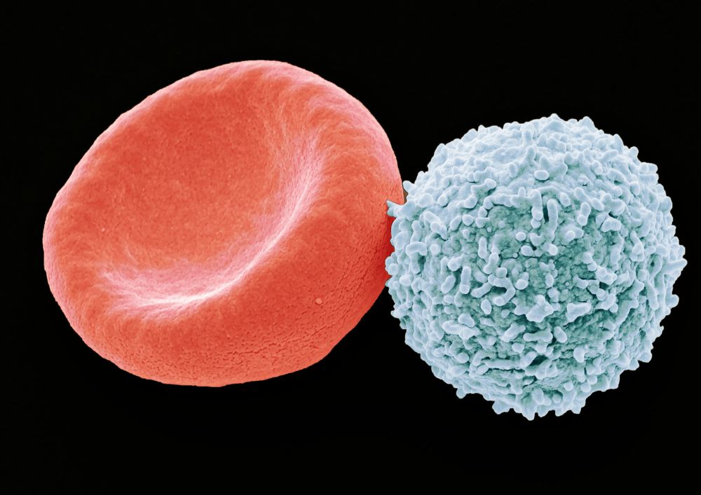 tvorba bielych krviniek